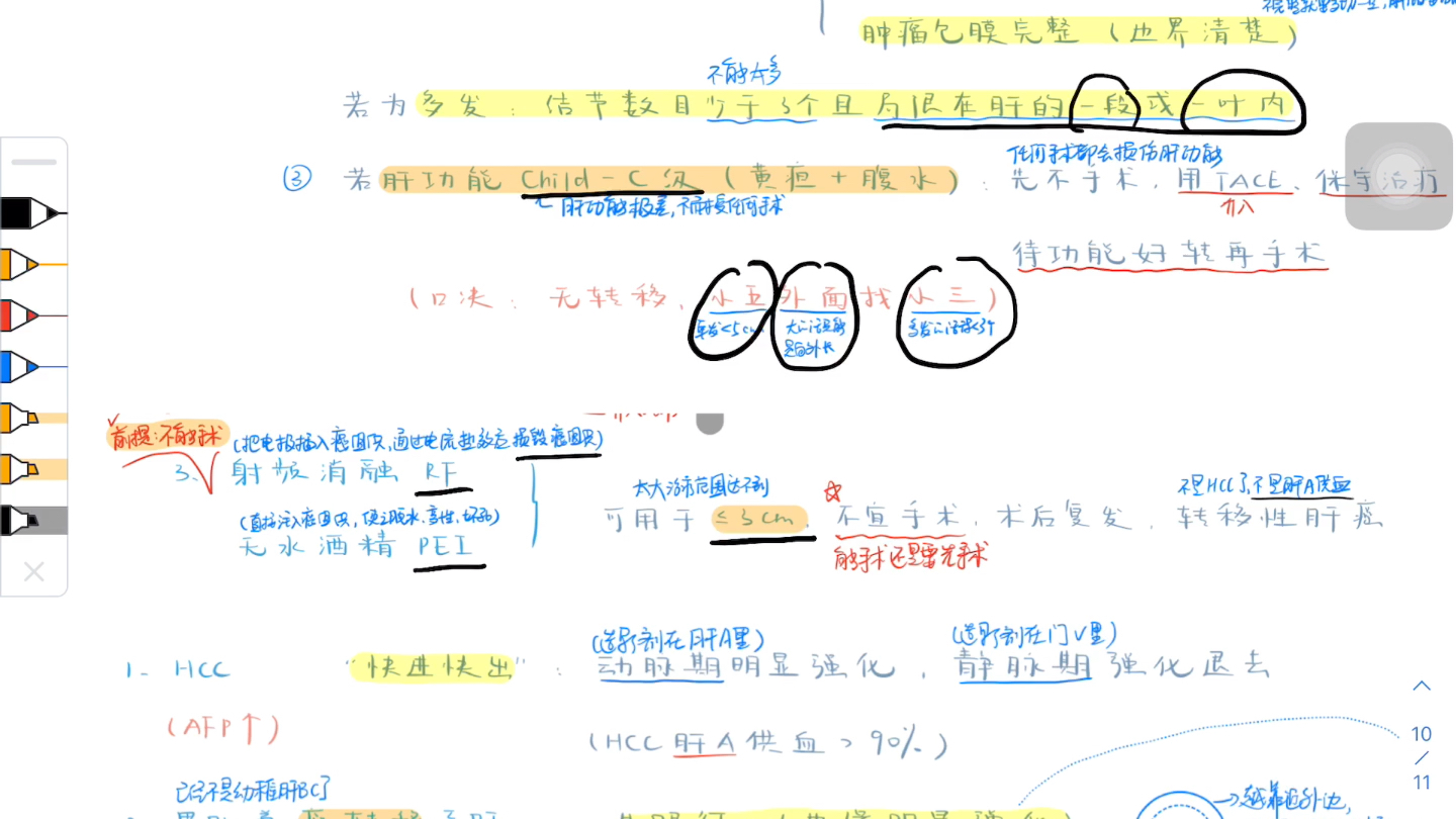 原发性肝癌HCC(自用)知识点速背哔哩哔哩bilibili