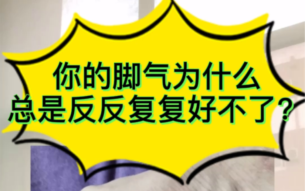 你的脚气为什么总是反反复复好不了?因为你忽略了鞋和袜子的杀菌!哔哩哔哩bilibili