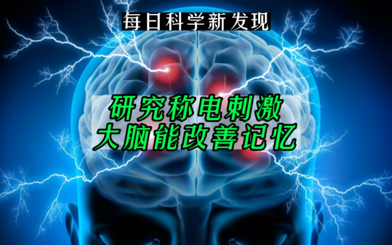 【每日科学新发现】研究称电刺激大脑能改善记忆哔哩哔哩bilibili