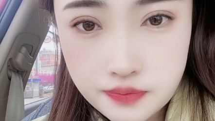 单眼皮变双眼皮8mm,平扇形,提肌 开内眼角,刚做完三个月