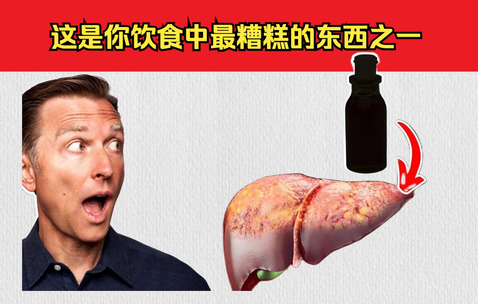 [图]一种对肝脏不好的东西，大部分人每天都在吃！哪些食物有益？