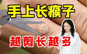 Download Video: 【科普】HPV长在手上，冷冻好还是激光好？