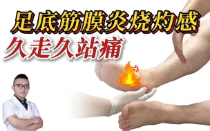 Download Video: 双脚足底筋膜炎脚底烧灼感、越走路越痛、治疗一疗程后真实反馈！