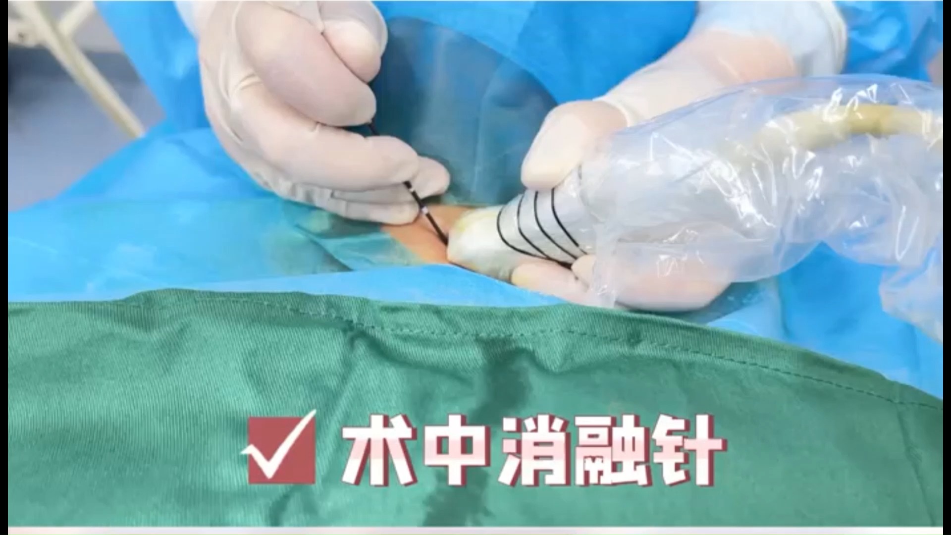 西安甲状腺消融术最好的医院排名【甲康高伟主任】74榆林丨多发4类