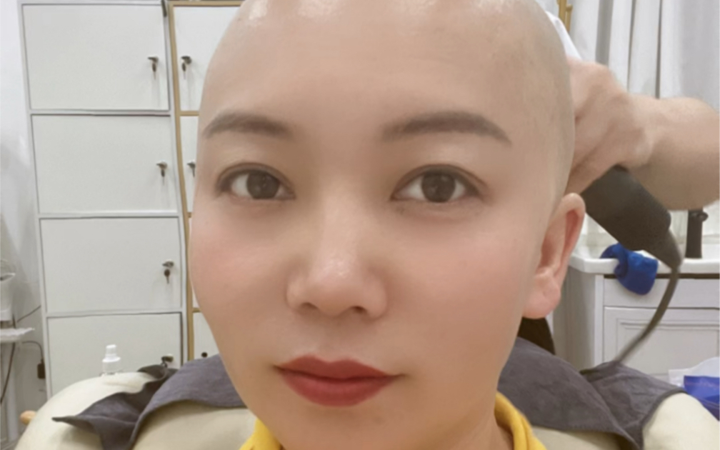 剃光头养发第80天第9次剃光头036902后脑勺冒痘痘检测还有炎症