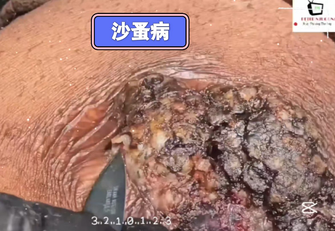 沙蚤病清理