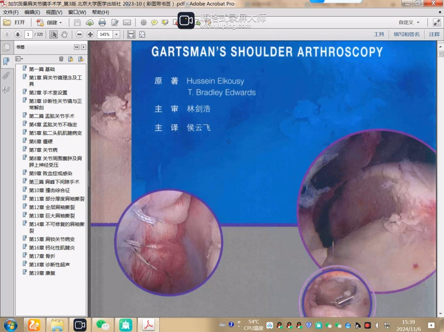 加尔茨曼肩关节镜手术学第3版 北京大学医学出版社 202310(彩图带书签)pdf哔哩哔哩bilibili