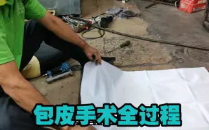 Tải video: 包皮手术全过程！非喜勿看！