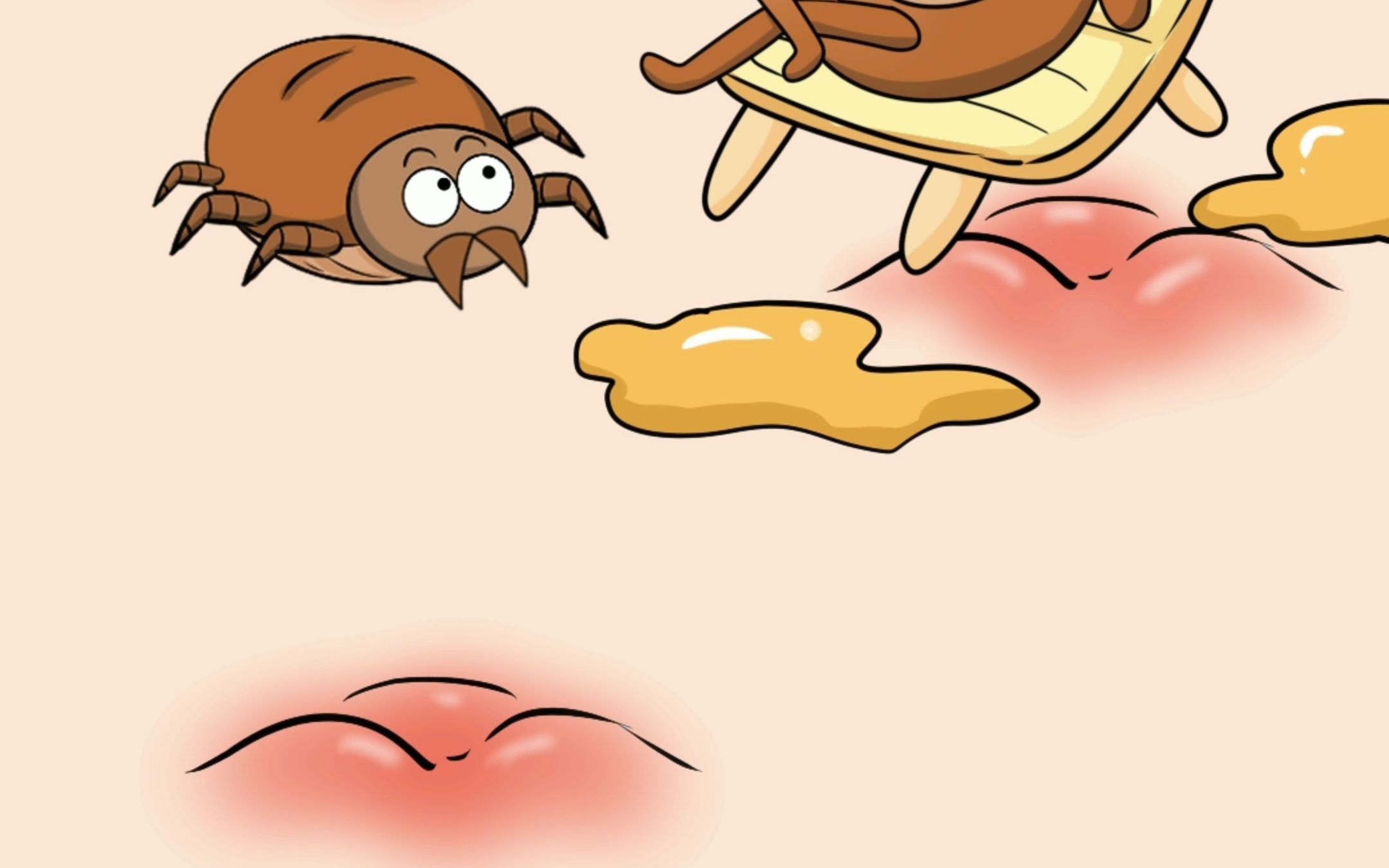 后背痘痘很可能是螨虫引起的