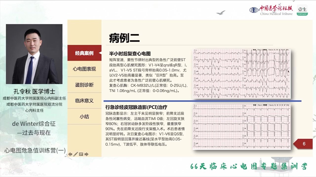 心电图危急值训练营哔哩哔哩bilibili