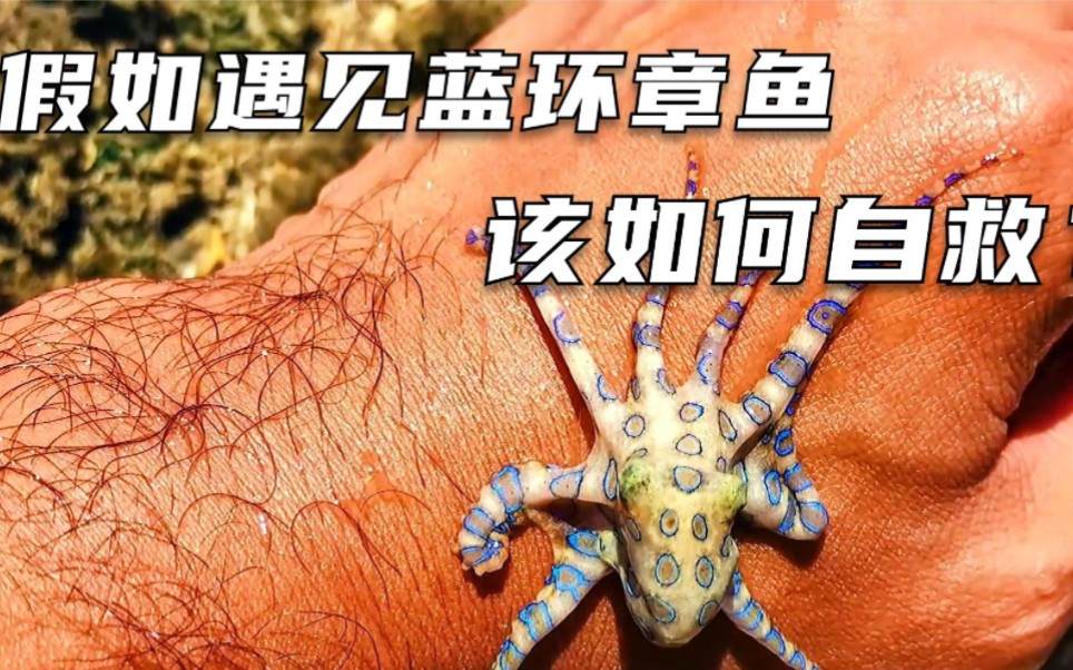 如果遇見藍環章魚該怎麼辦?在這種劇毒生物面前,還有救嗎?