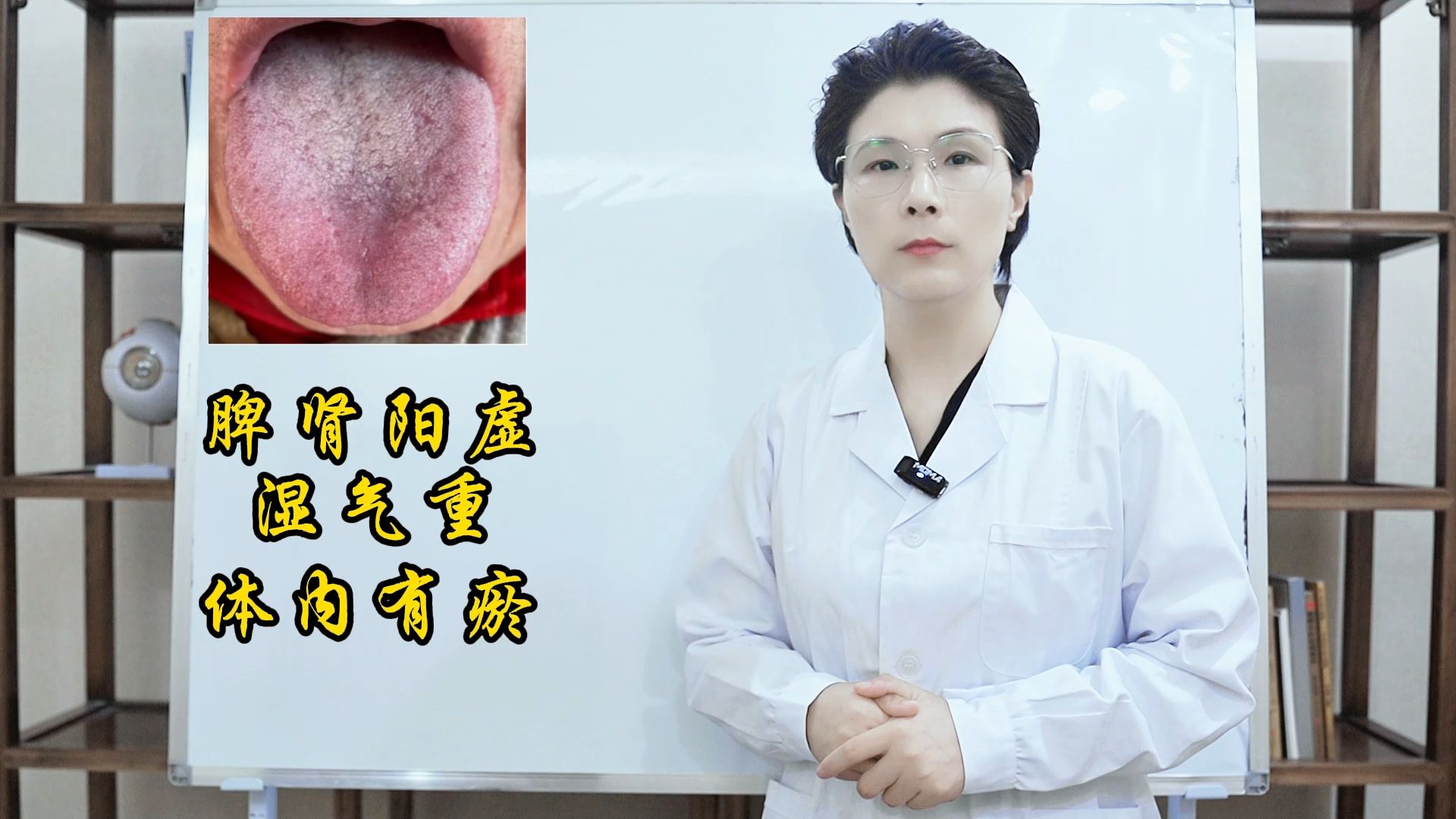 这种舌头,瘀血不除,越补越毒!补到最后一身病!