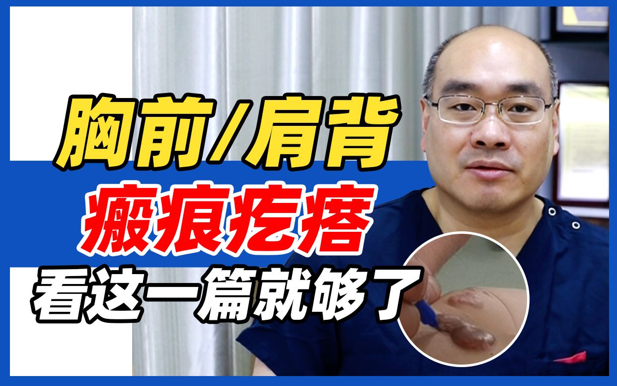 胸前,肩背瘢痕疙瘩怎么办?看这一篇就够了