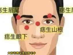 Download Video: 男人眉毛上不同位置有痣代表什么，是大富大贵之相吗？