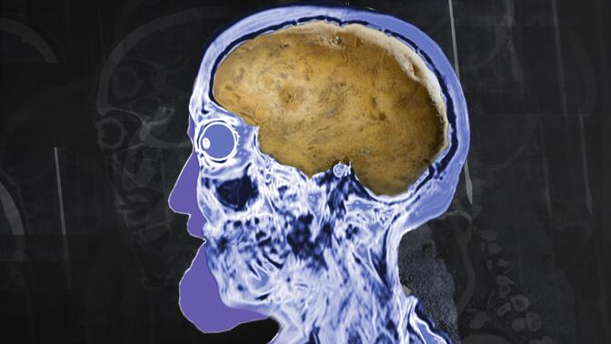 一个囚犯在晚餐时吃了放了2周的烤土豆，这是他的大脑发生的变化