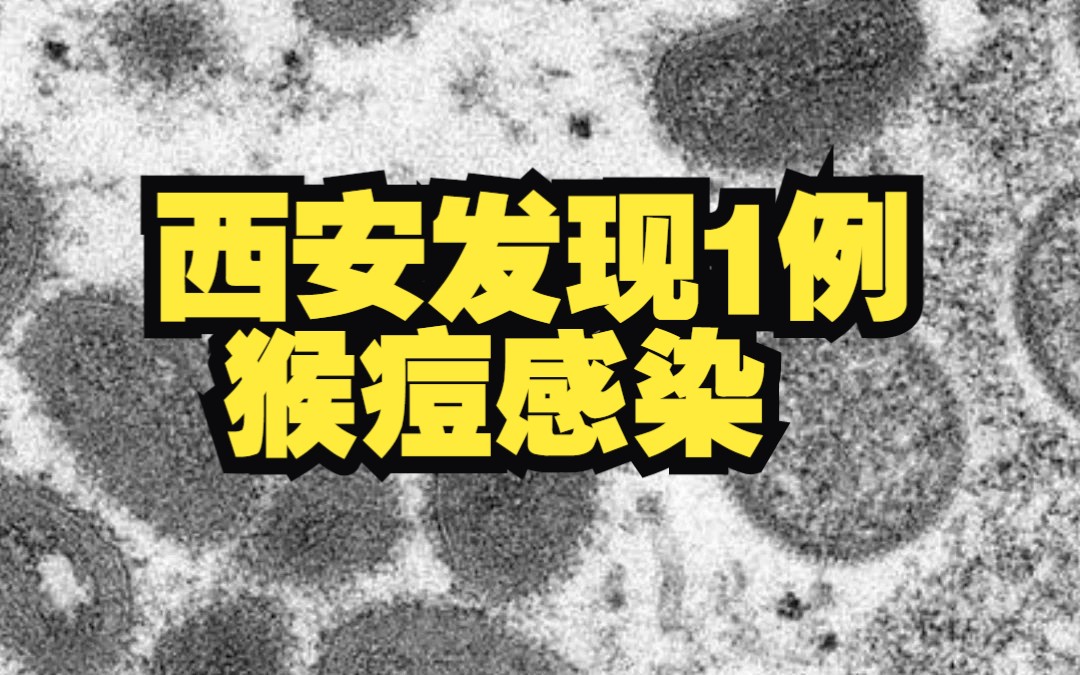 陕西西安发现1例猴痘病毒感染病例,患者正在进行隔离治疗 情况稳定哔哩哔哩bilibili