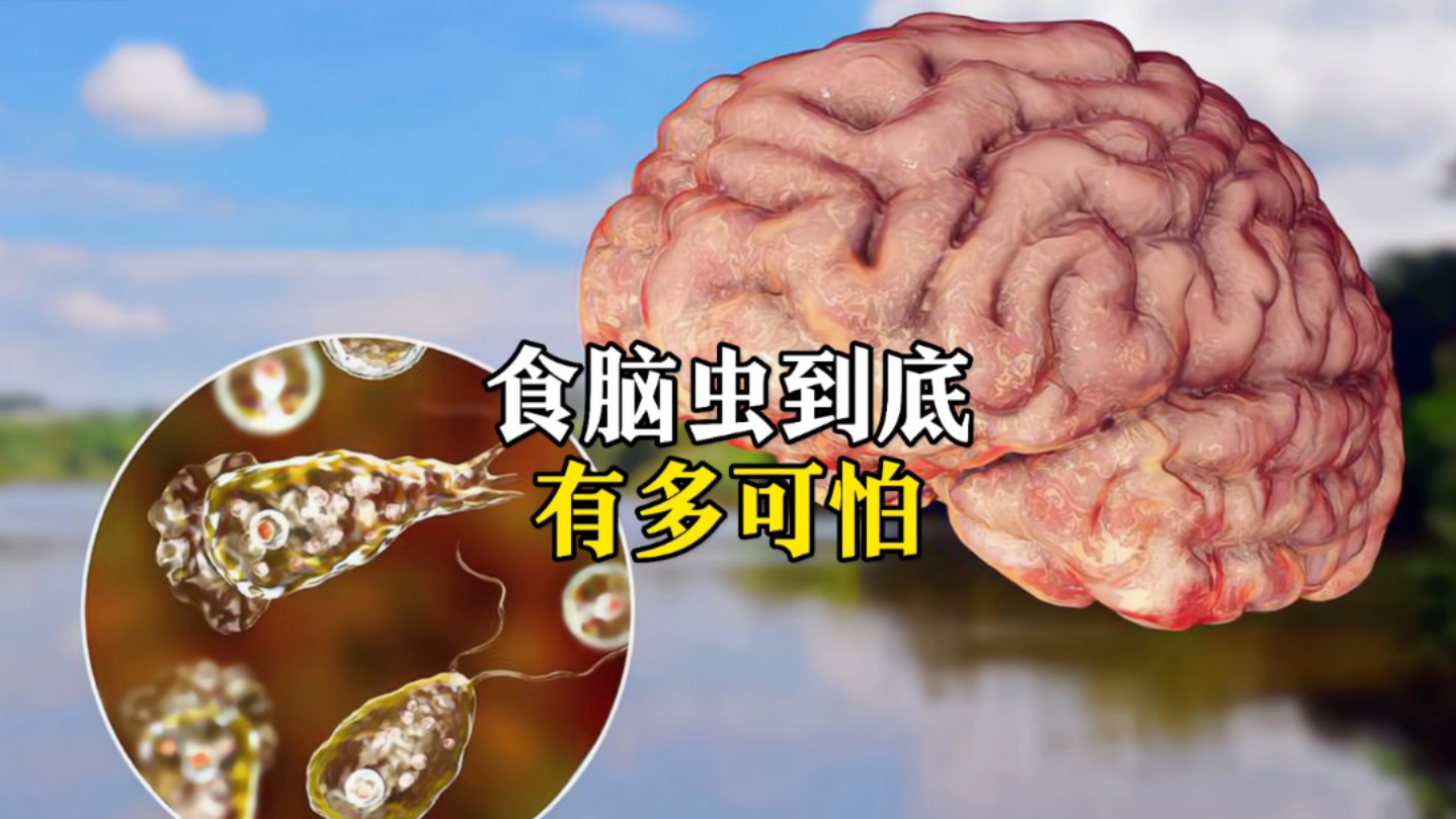 食脑虫到底有多可怕哔哩哔哩bilibili