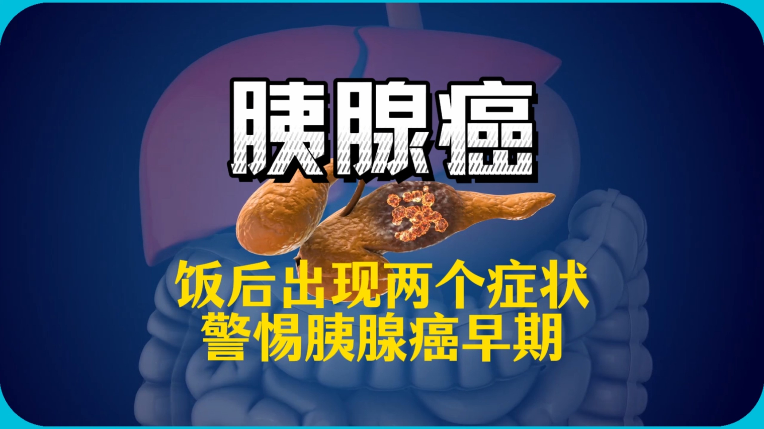 饭后出现两个症状，警惕胰腺癌早期！
