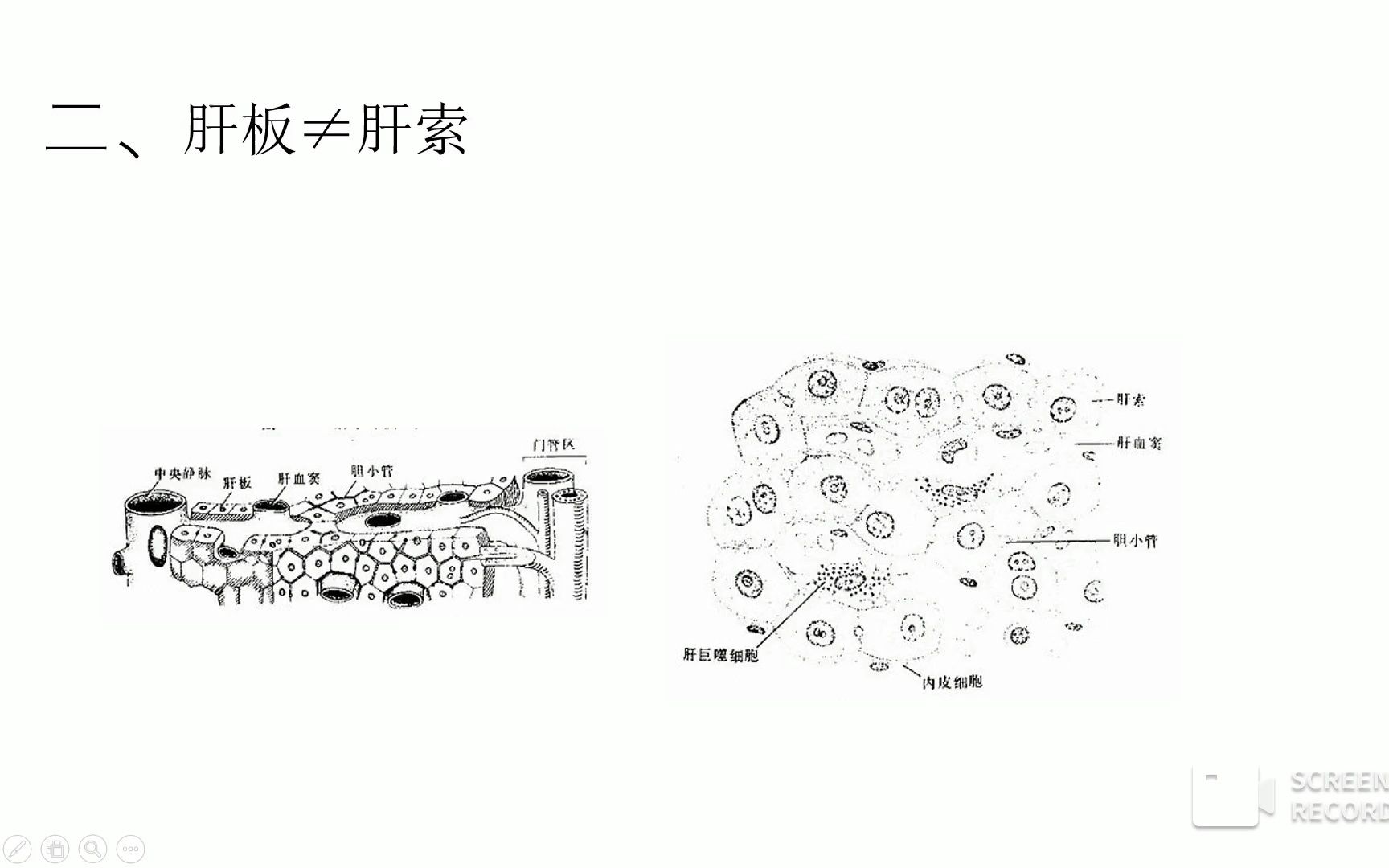 病理学小知识肝板#肝索哔哩哔哩bilibili