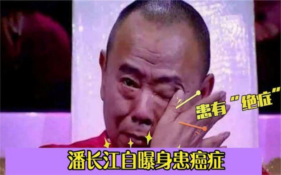 潘长江已确诊了绝症,被医生定了死刑,但依然乐观面对生活!哔哩哔哩bilibili