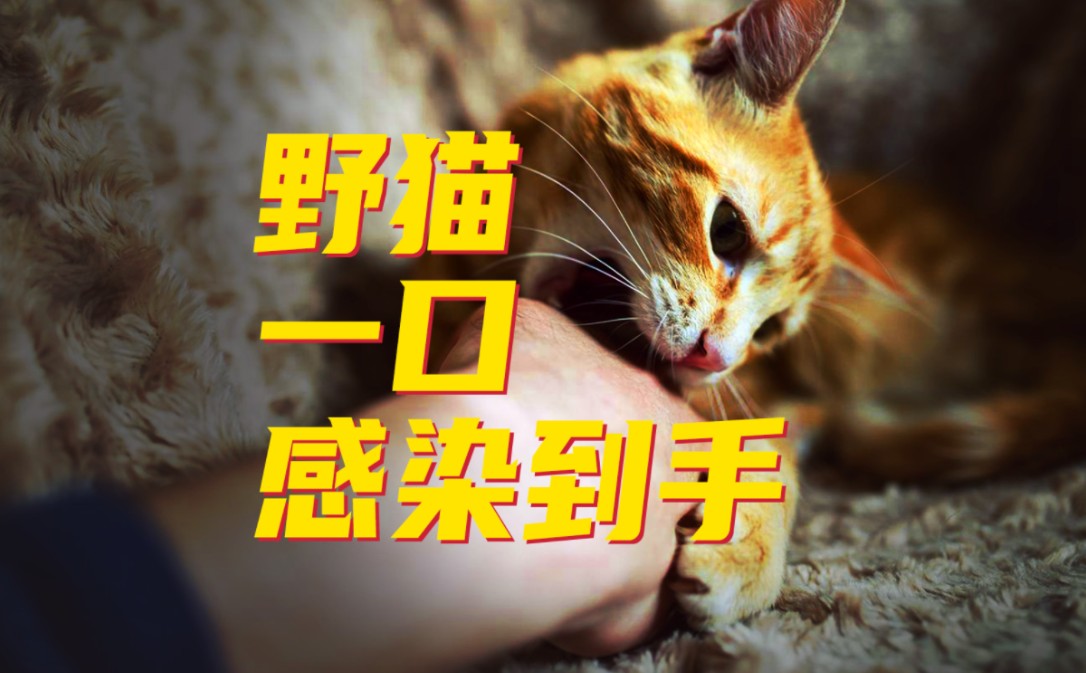 鹦鹉热?猫爪热 ?还是看了不该看的头昏发热…哔哩哔哩bilibili