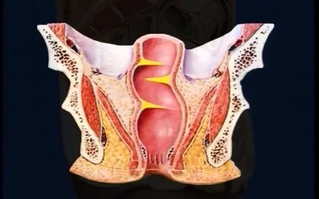 [图]肛管直肠高清晰解剖视频（上集）