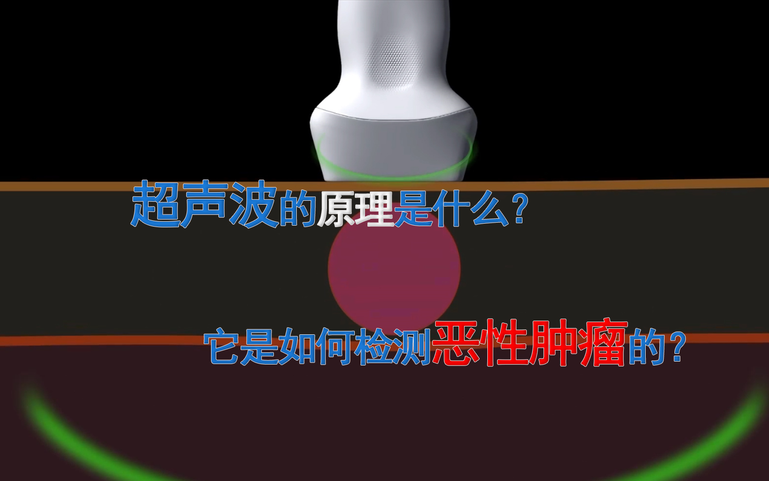 超声波是怎样看到人体内部的?多普勒超声又是什么原理?哔哩哔哩bilibili