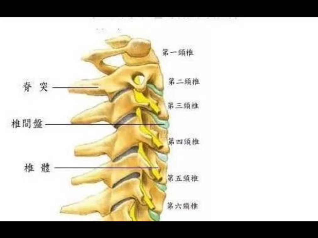 颈1横突综合征