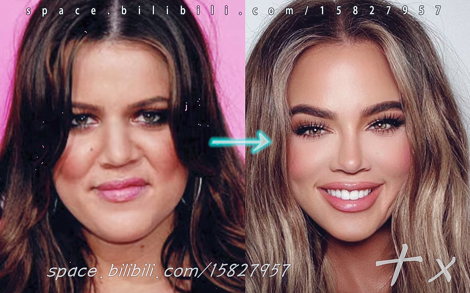 [图]《卡戴珊家族Khloe整容史》 Kardashian: Plastic Surgery (2020) | 高清剪辑.十x