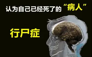 这些发生在人类身上的罕见病症你见过几个？能把人笑死的病你听说过吗？