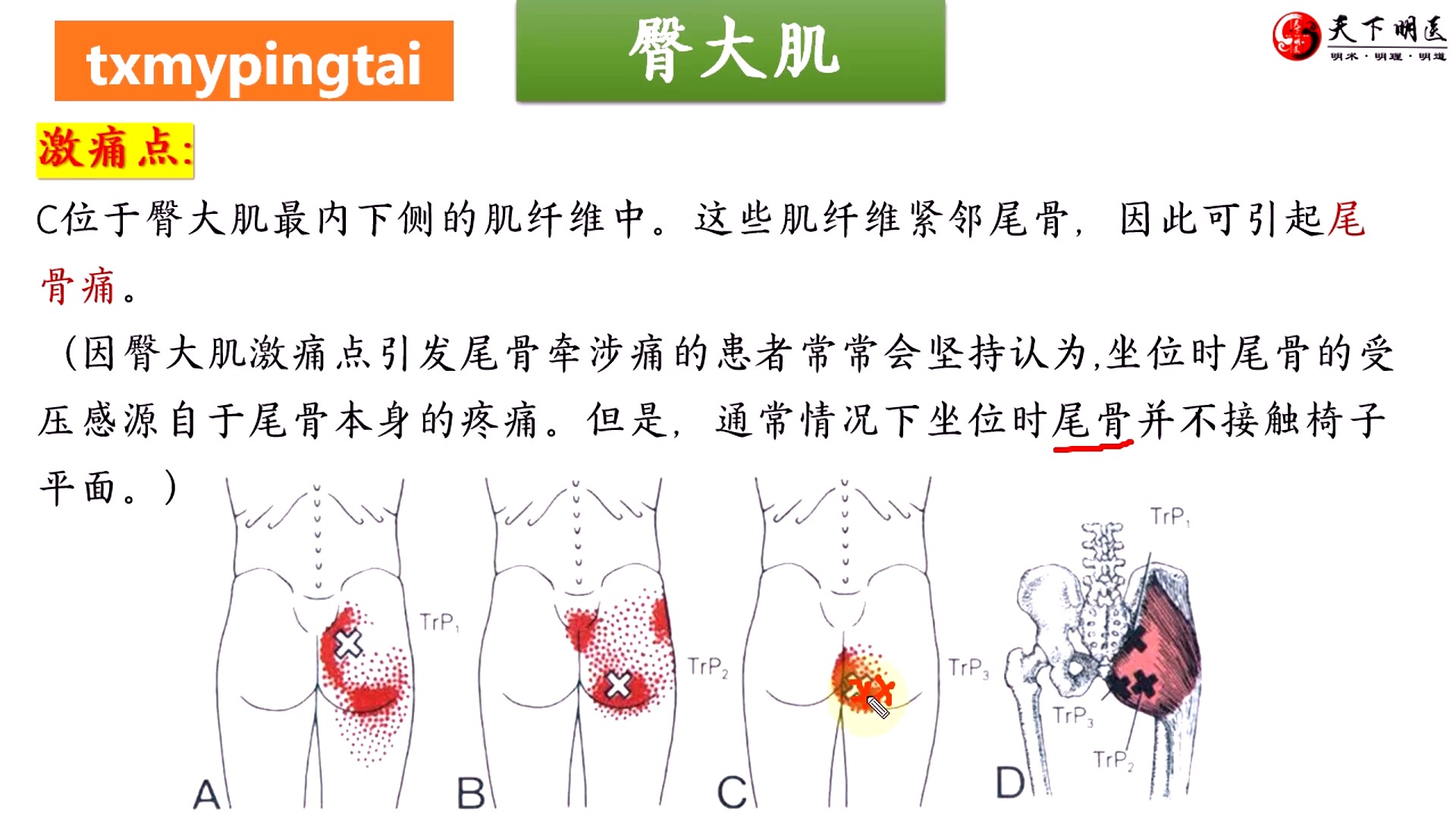 【臀大肌】3d解剖——臀部痛,骶部痛,不能坐!