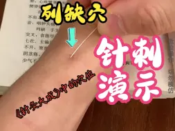 Descargar video: 列缺穴针刺演示，《针灸大成》是如何定位列缺穴的？