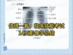 Download Video: 执医技能第一站影像学解读❗就靠这14页了✅考试再也不蒙圈了