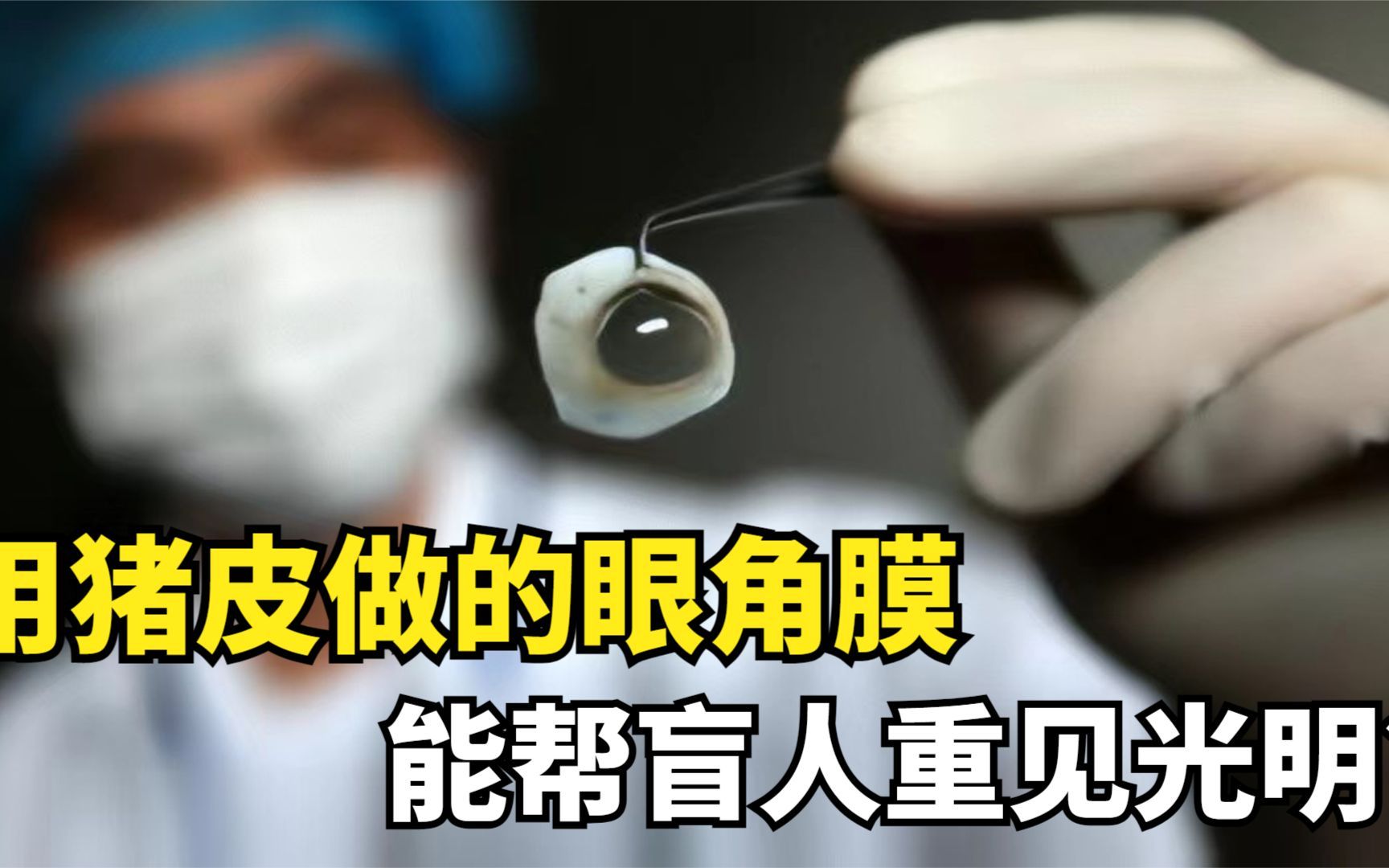 专家用猪皮做眼角膜,已让20名盲人恢复视力,失明或将被彻底治愈哔哩哔哩bilibili