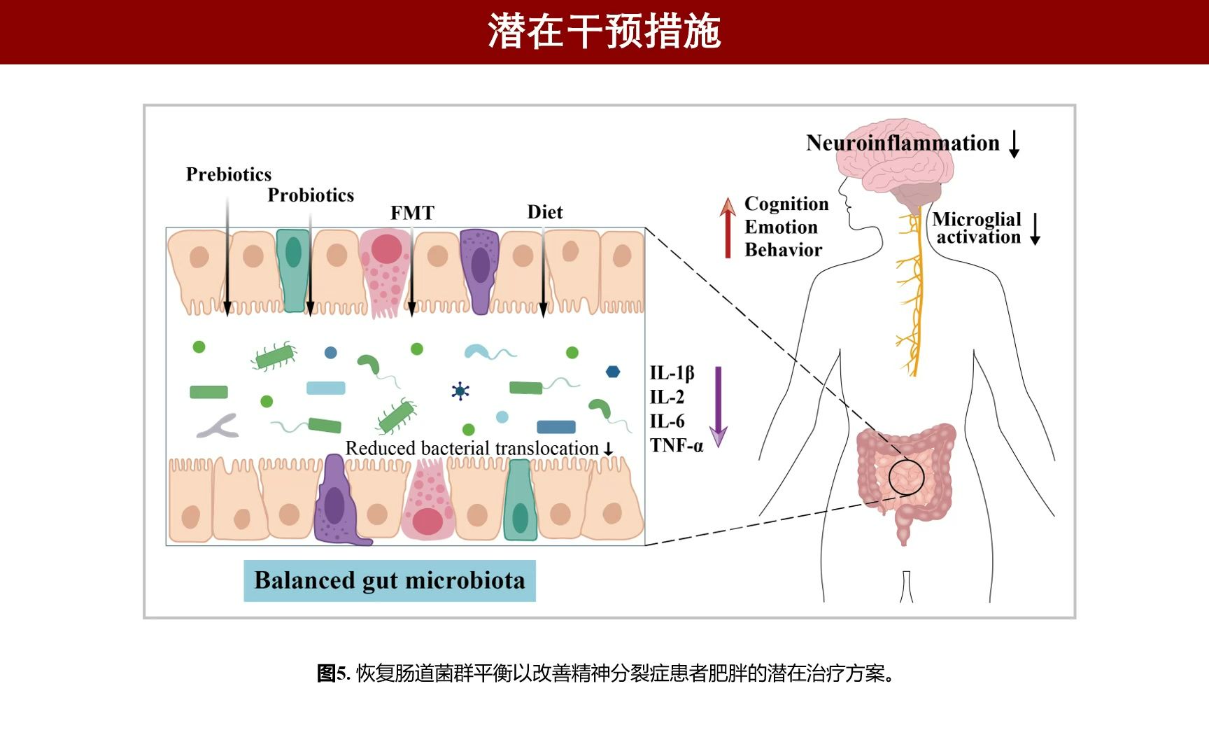 iMeta |吴小立/谢黎炜综述肠道菌群可能作为精神分裂症和肥胖症发病机制的共同枢纽哔哩哔哩bilibili