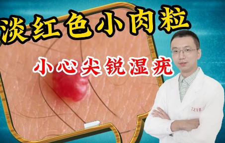 淡红色小肉粒 小心尖锐湿疣哔哩哔哩bilibili