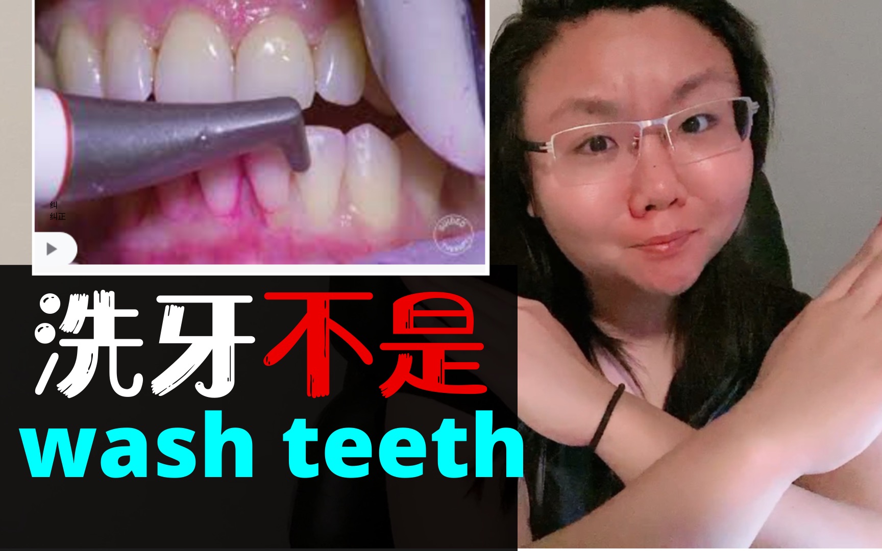 洗牙千万不要说wash teeth 超级实用英语地道表达自查方法哔哩哔哩bilibili