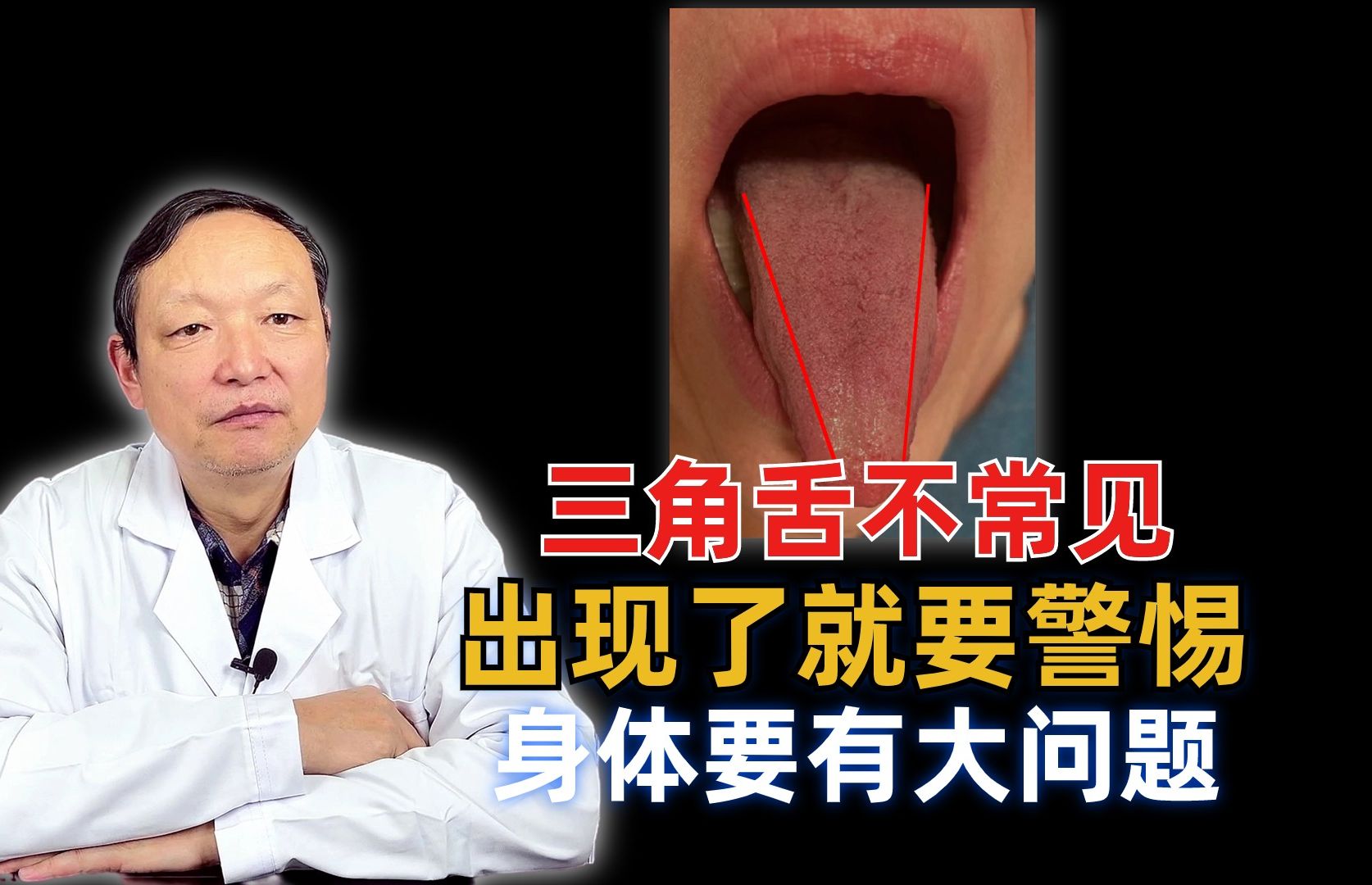 三角舌不常见,出现了就要警惕,身体要有大问题
