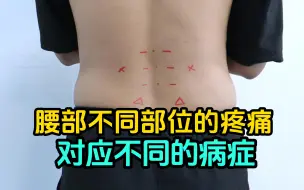 Download Video: 腰椎不同部位的疼痛，对应不同的疾病