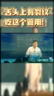 Download Video: 看看你的舌头是不是有裂纹？吃这个管用