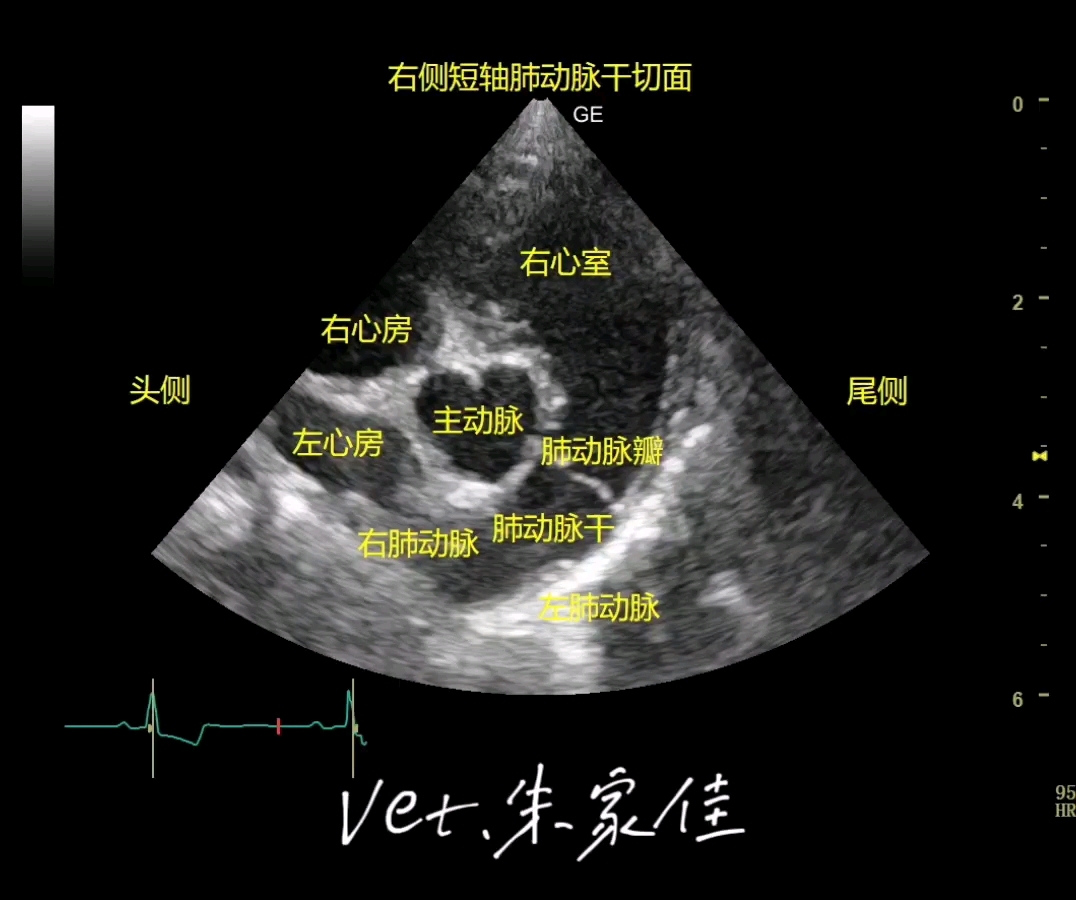 心脏超声5个标准切面图片