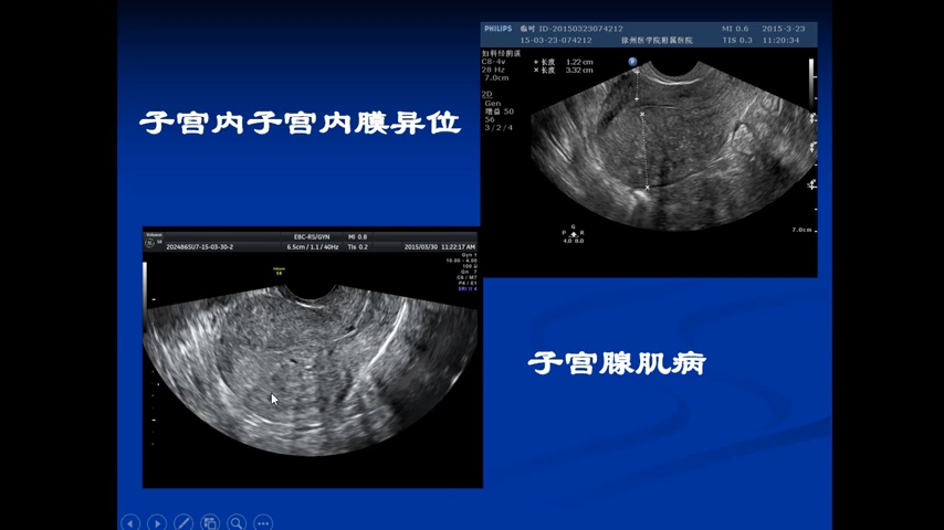 [图]妇科学习视频4