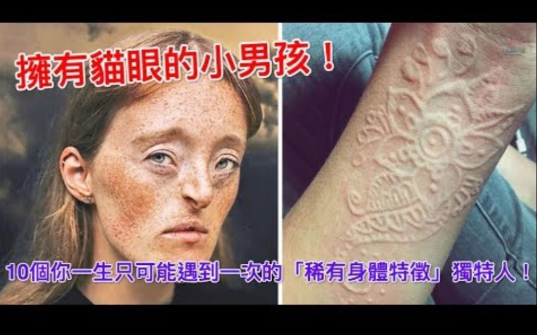 10个你一生只可能遇到一次的「稀有身体特征」人!拥有猫眼的男孩!哔哩哔哩bilibili