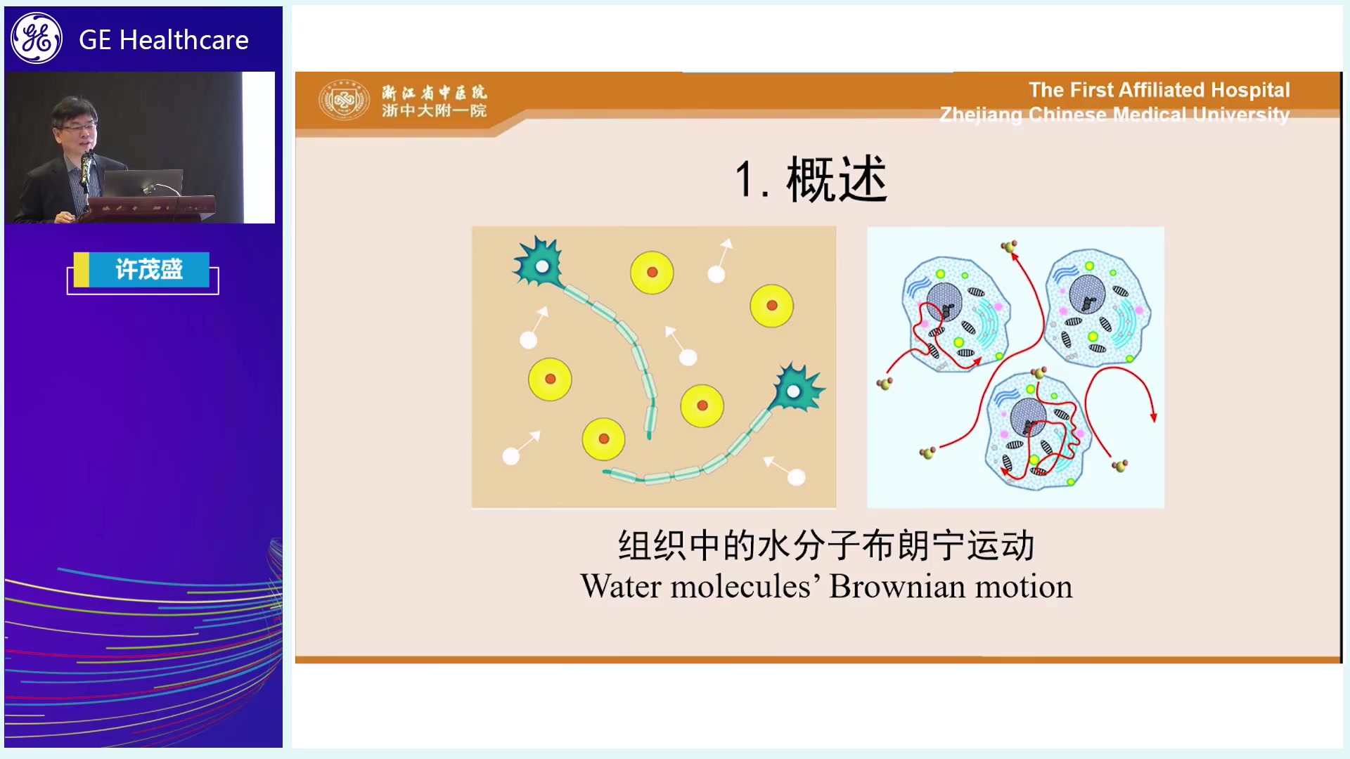 弥散加权成像原理及临床应用哔哩哔哩bilibili