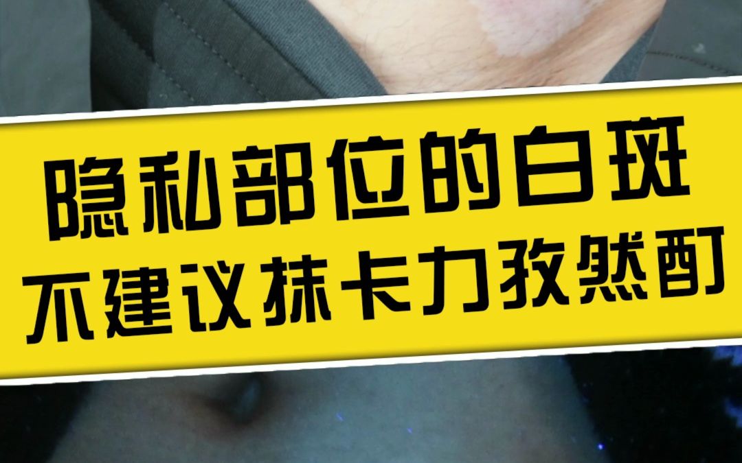 隐私部位的白斑,不建议抹卡力孜然酊哔哩哔哩bilibili