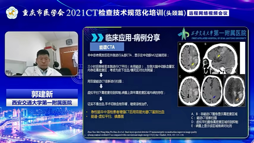 [图]1.颅脑 CT 检查技术规范与临床应用(流畅版)