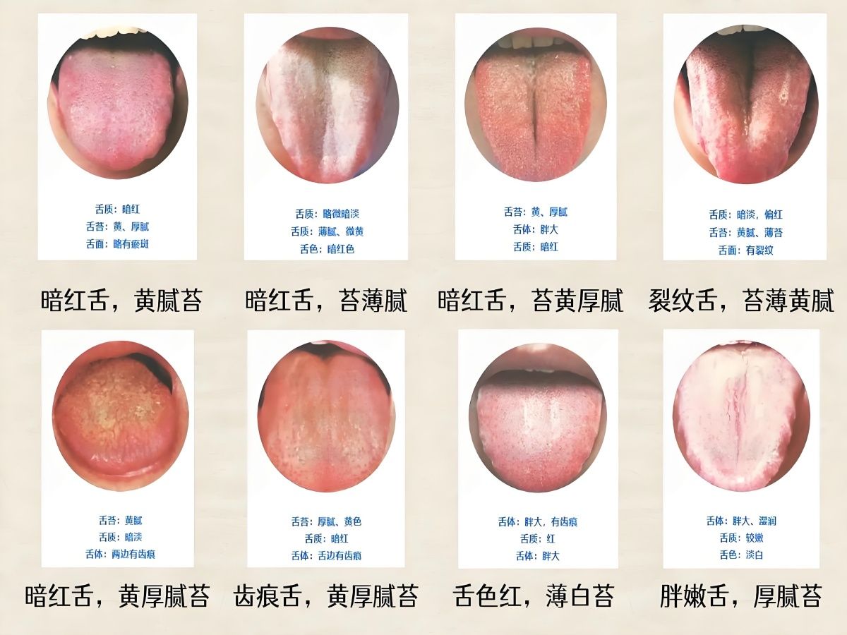 [图]中医舌诊教学