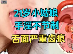 Video herunterladen: 21岁小姑娘，夜晚手淫频繁，舌面严重齿痕，使劲糟蹋身体！！