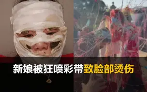 下载视频: 新娘被狂喷彩带，脸部被烫伤缠满绷带