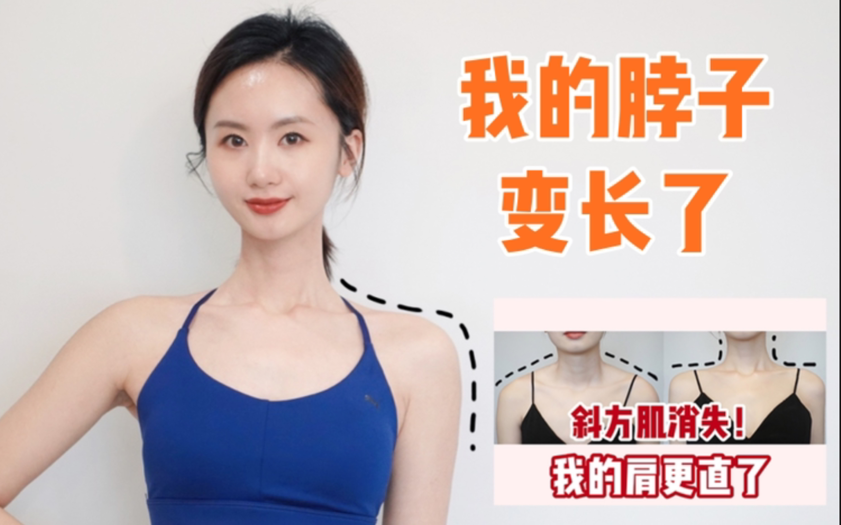 跟练拥有直角肩之后斜方肌没了脖子竟然也变长了